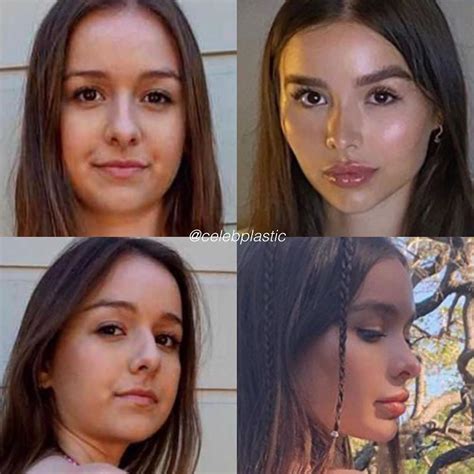 Sophie Mudd Plastic Surgery